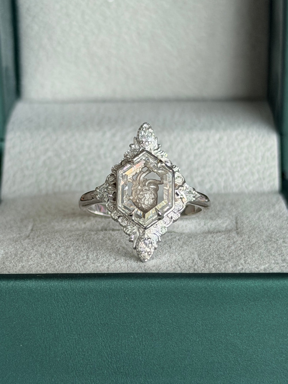 Ankita's Ring