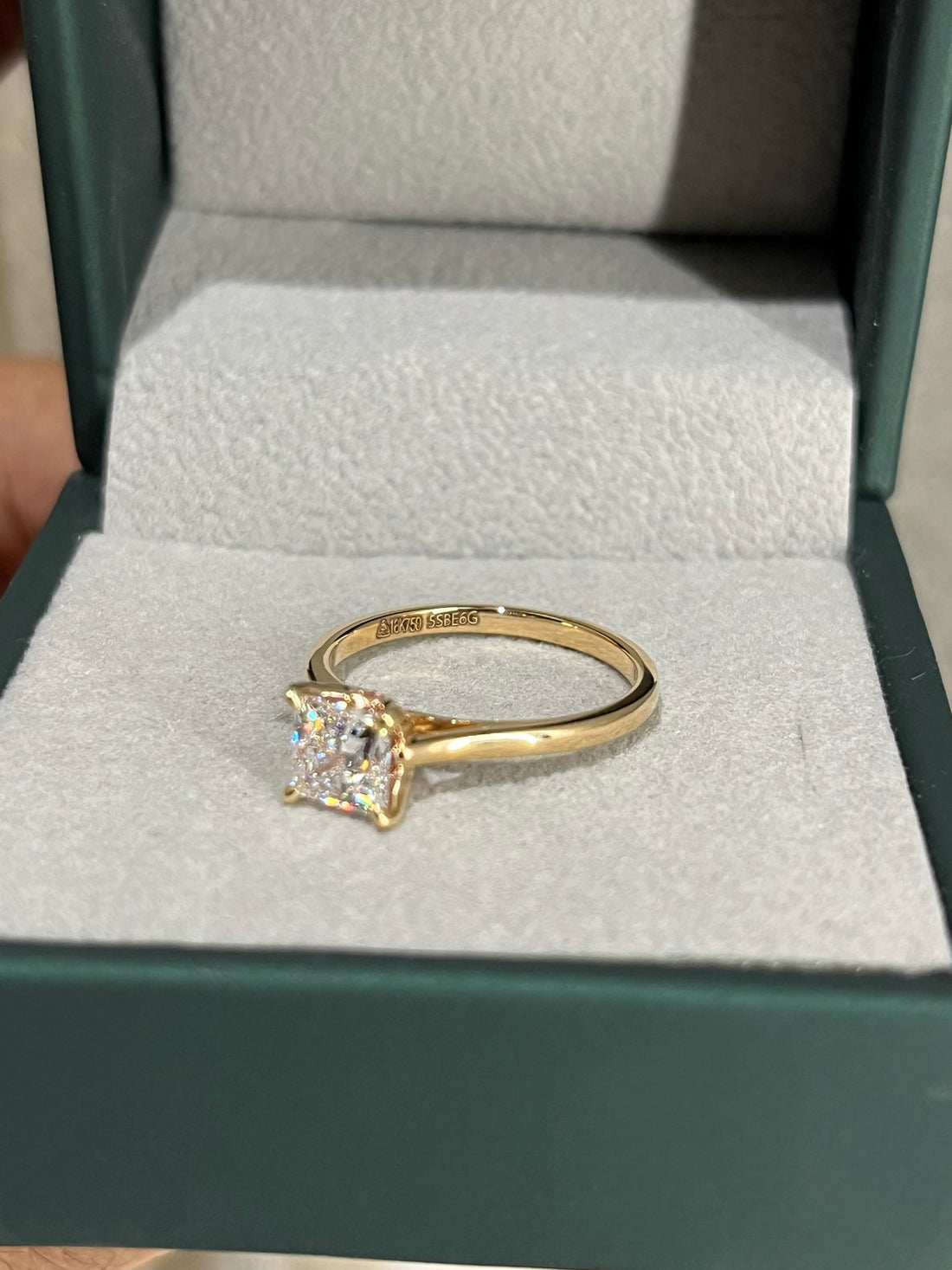 Anushka's Ring